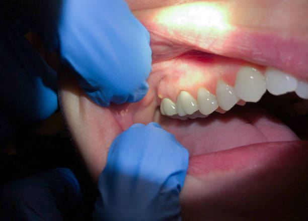Best Orthodontic Emergency Dentist in Tuscumbia, AL