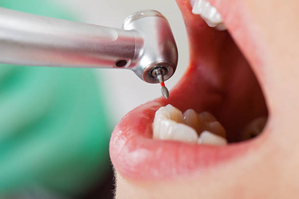 Best Emergency Dentist for Special Needs Patients in Tuscumbia, AL